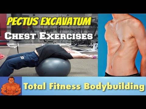 Chest Stretching Exercises for Pectus Excavatum (sunken chest)