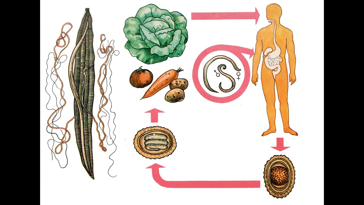 Передаются ли аскариды от человека к человеку. Глистные инвазии острицы аскариды. Глисты аскариды острицы у детей. Аскарида человеческая пути заражения. Геогельминтозы (аскаридоз).