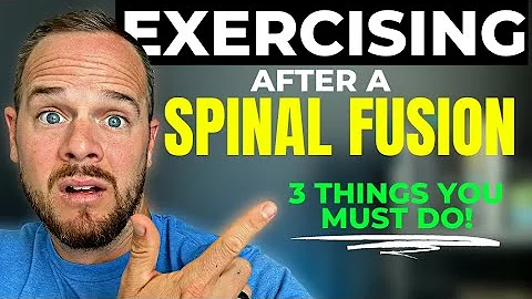 Can I Lift Weights After Spinal Fusion Surgery?: 3 MUST FOLLOW RULES