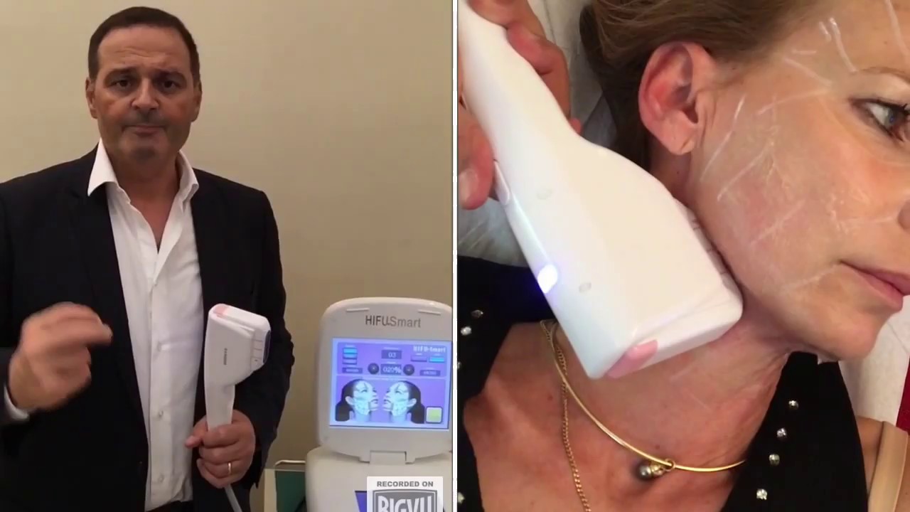 Lifting Médical du visage- HiFu - Centre Médical Esthétique Lamarck - Paris