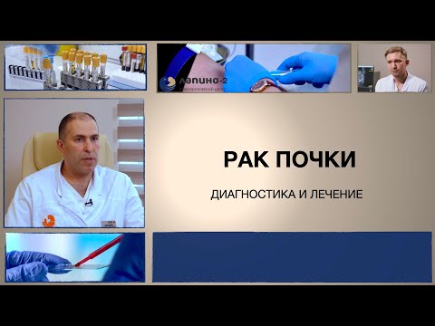 Рак почки: варианты лечения.