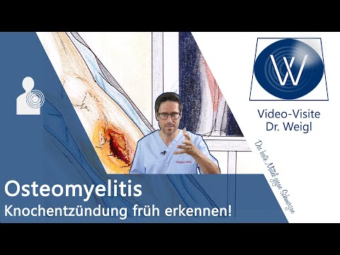 Video: Osteomyelitis - Ursachen Und Symptome Einer Akuten Und Chronischen Osteomyelitis, Diagnose Und Behandlung