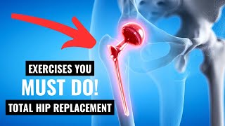 You MUST Do This After Hip Replacement!