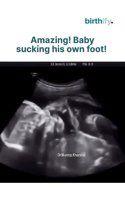 Incredible Ultrasound: Baby Caught SUCKING Its Own FOOT in the Womb!