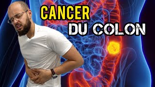 Les symptômes du CANCER du COLON que vous ne devez pas ignorer !