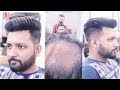 8929576395, 8882017181 non surgical hair replacement for men  by master RIZY