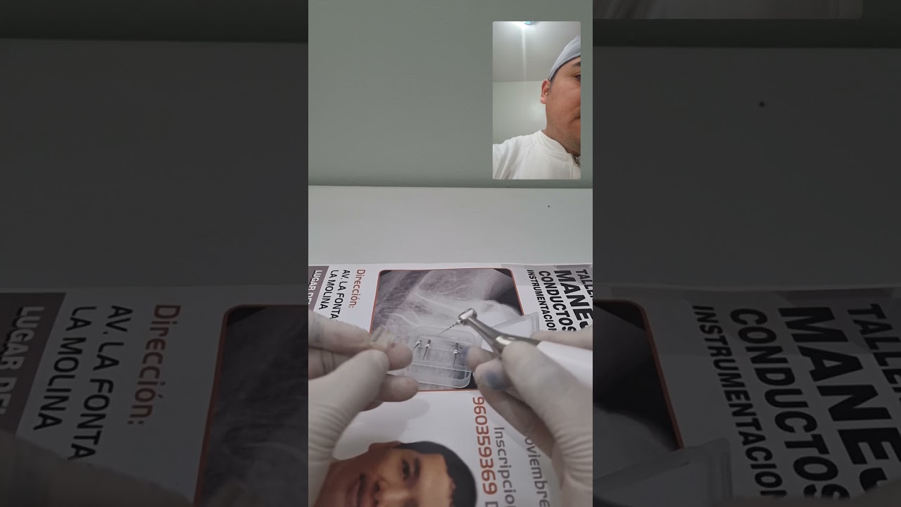 limas de retratamiento  d file