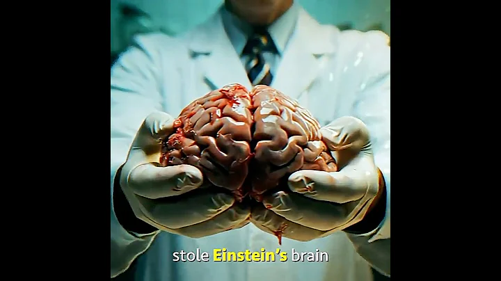 He stole Einstein's Brain...