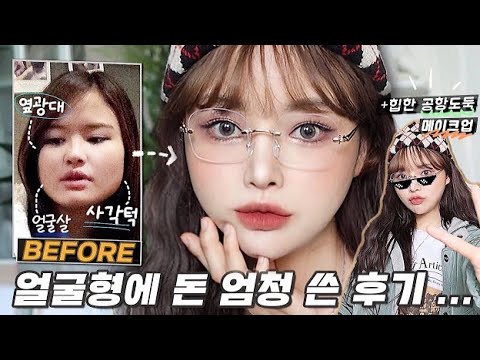 지금까지 받은 얼굴형 관리 썰&amp;amp;찐후기 푼다🔥(시술 추천or비추천)| 비니 쓰고 HIP한 공항도둑st 메이크업🤬🤓|울쎼라/<strong>인모드</strong>/에어젯/윤곽주사/보톡스 등등