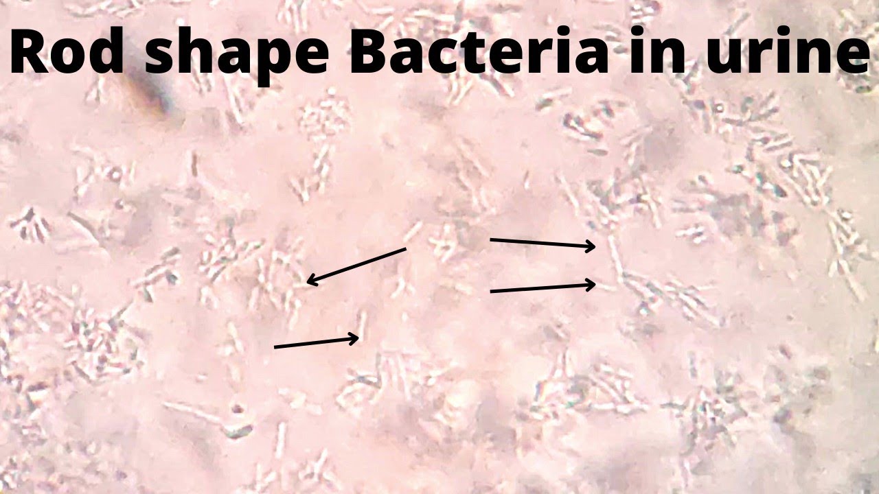Rod Shape Bacteria In Urine Motile And Non Motile rod-shape-bacteria-in-urine-motile-and-non-motile
