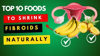 Top 10 foods to shrink fibroids naturally and fast!! screenshot 4