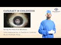 Cataract in Childhood | Saving the kids from blindness | Lens implantation in Paediatric Cataract