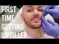 My First Lip Filler Experience | Juvederm Ultra XC