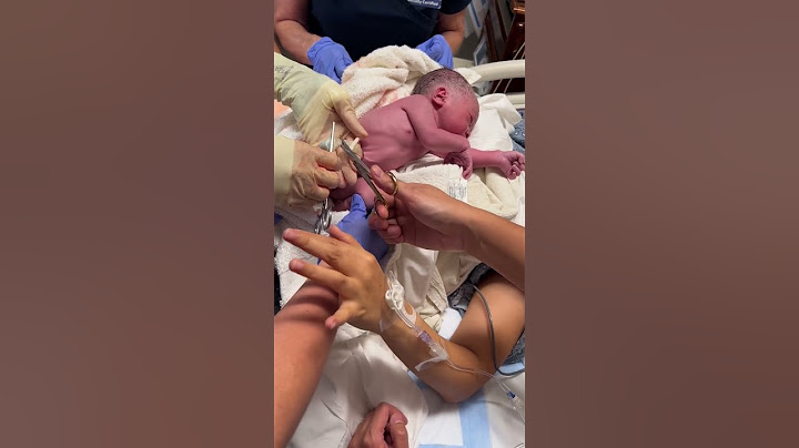 Our firstborn umbilical cord cutting. #newborn  #umbilicalcord  #newparents  #babies #baby  #babyboy