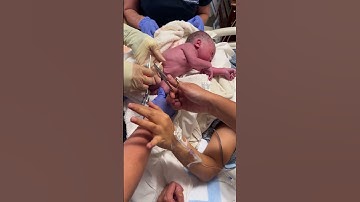 Thumbnail of Our firstborn umbilical cord cutting. #newborn  #umbilicalcord  #newparents  #babies #baby  #babyboy
