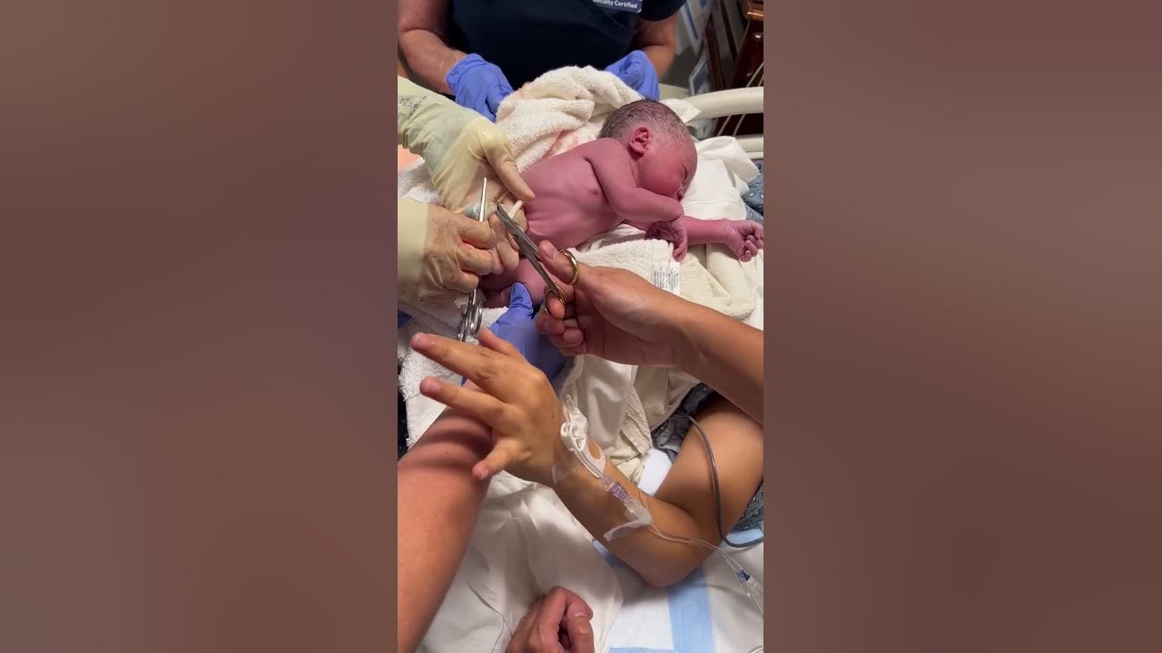 Our firstborn umbilical cord cutting. #newborn  #umbilicalcord  #newparents  #babies #baby  #babyboy
