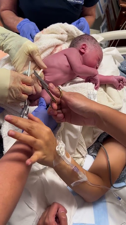 Our firstborn umbilical cord cutting. #newborn  #umbilicalcord  #newparents  #babies #baby  #babyboy