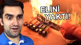1000 Derece Biçak Ve Çakmak - Eli̇ni̇ Yakti