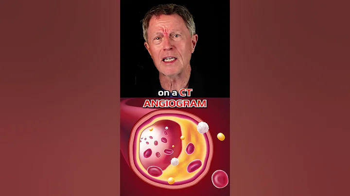 The Truth About LDL-Cholesterol: New Evidence