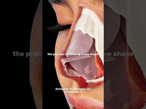 چرا نوک سینه بعد از جراحی زیبایی بینی پایین می آید