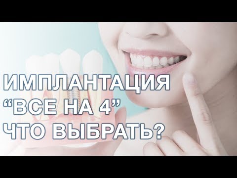 Съемное протезирование или all on 4, что выбрать?