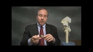 Hip Replacement Surgery | What to Expect