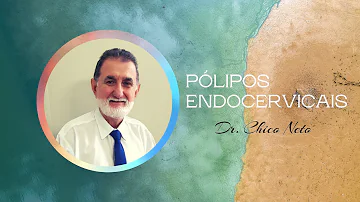 O que é sem particularidade?