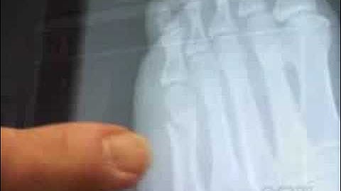 InteleViewer to the rescue !