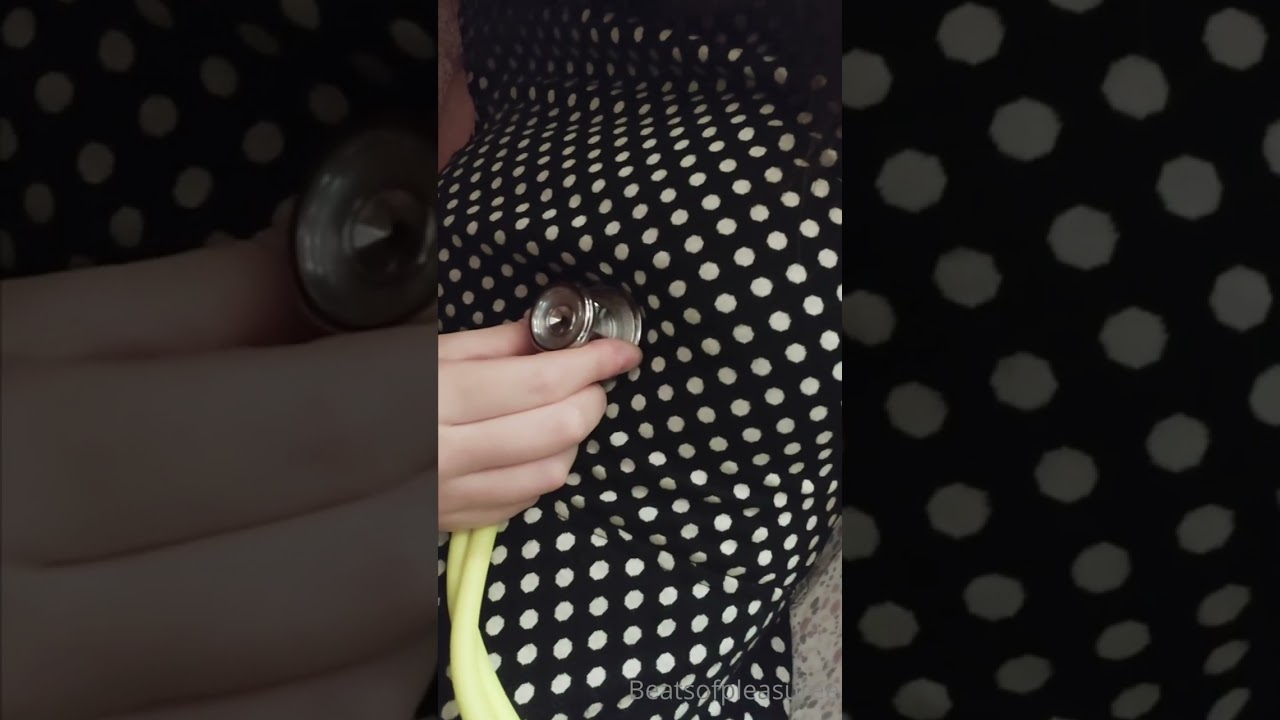 The young lady's heartbeat after exercise