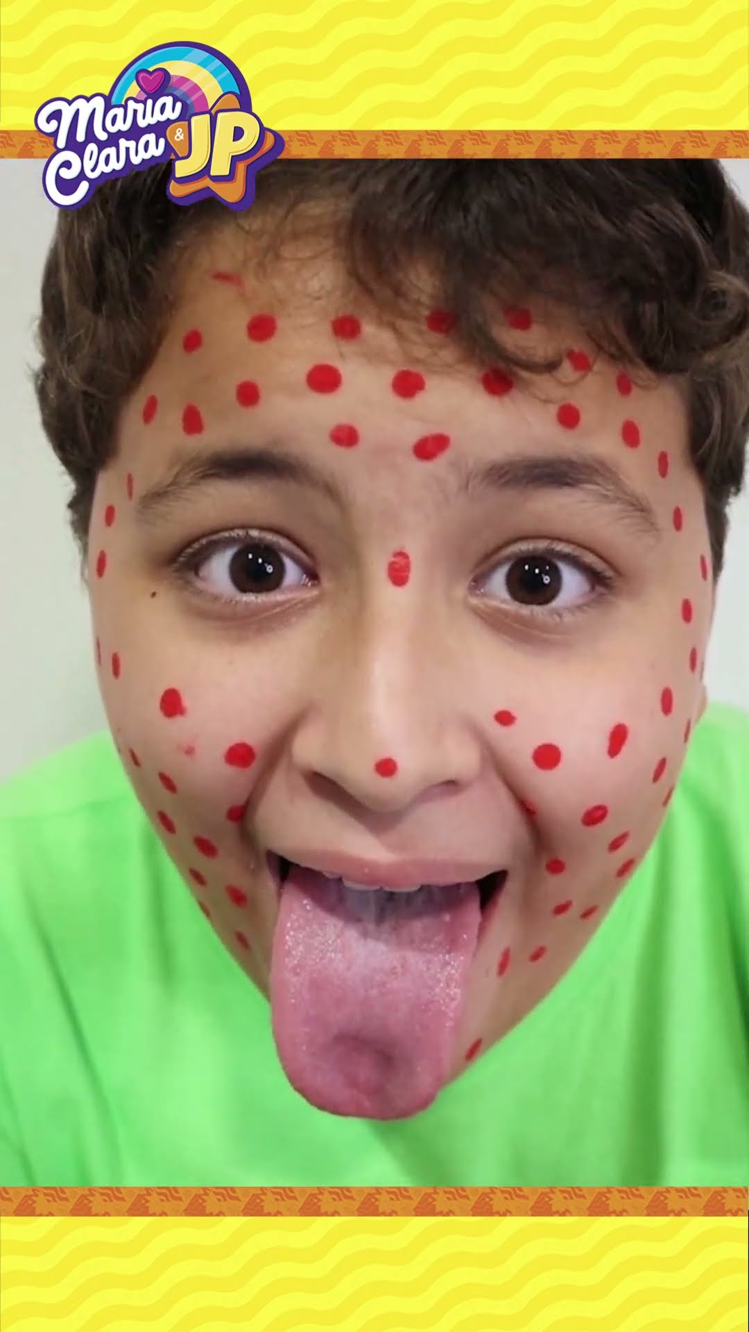 Maria Clara is a doctor and cures JP of chickenpox