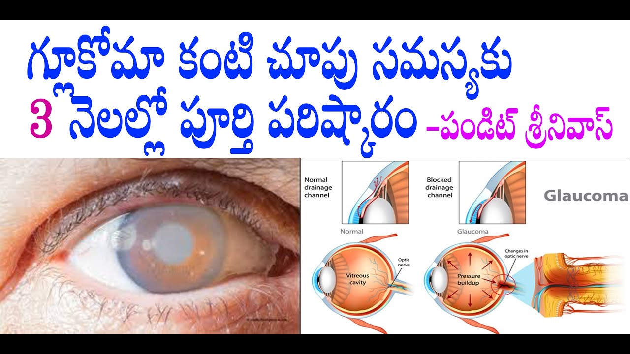 Best Treatment in Ayurveda charakudu panditsrinivas 