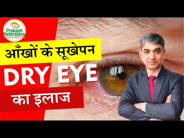 Say Goodbye to Dry Eyes with Ayurveda | Natural Eye Care Tips | Prakash Nethralaya Jaipur