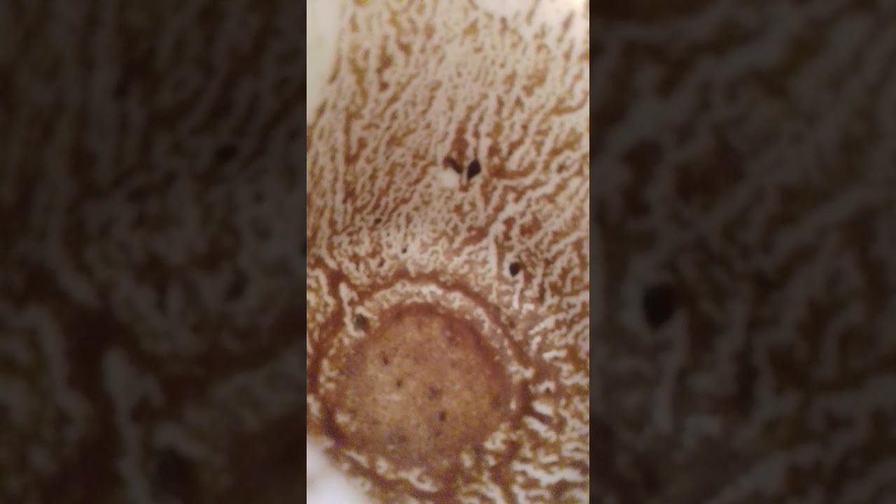 برج السرطان حمل🤰 بداية جديدة وفرحه🤲 تغيير في الوزن،نجاه من خطر 🤲، نصره بعد يأس ✅👍💯