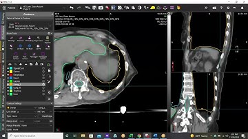 Contour ProtégéAI: Using AI Auto-Contours Effectively