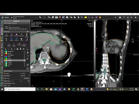 Contour ProtégéAI: Using AI Auto-Contours Effectively