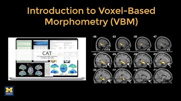 CAT12 Tutorial #1: Download and Install