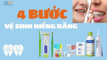 Kinh nghiệm niềng răng - Cách vệ sinh răng miệng khi niềng răng