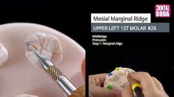 Upper Left 1st Molar  mesial marginal ridge 1 marginal ridge (middle-aged) Wax-Up #26-4A