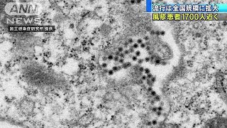 風疹患者数1692人に　今週も増加・・・拡大止まらず(18/11/06)