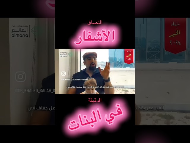 التصاق الأشفار في البنات