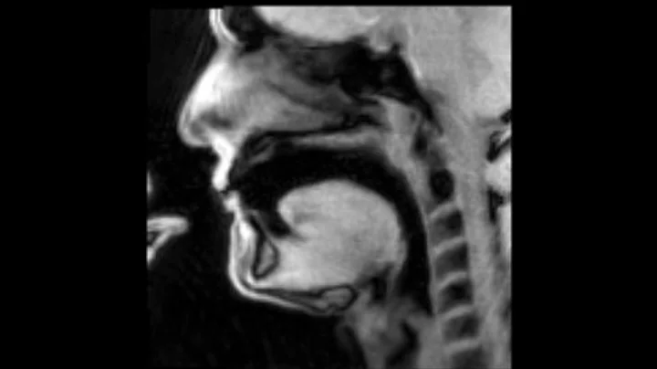 Douglas Yeo, trombone - MRI video 1 - lip slurs