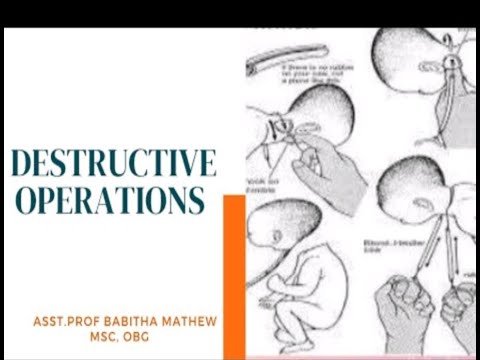 Dustructive Operations Destructive operations lecture - YouTube