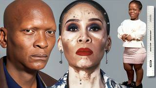 10 South African Celebs Who Live With Shocking Body Conditions