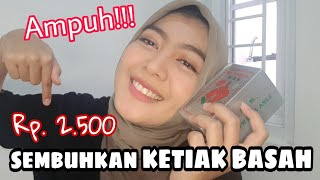 Tips Mengatasi Ketiak Basah Parah