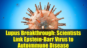 Lupus Breakthrough: Scientists Link Epstein-Barr Virus to Autoimmune Disease