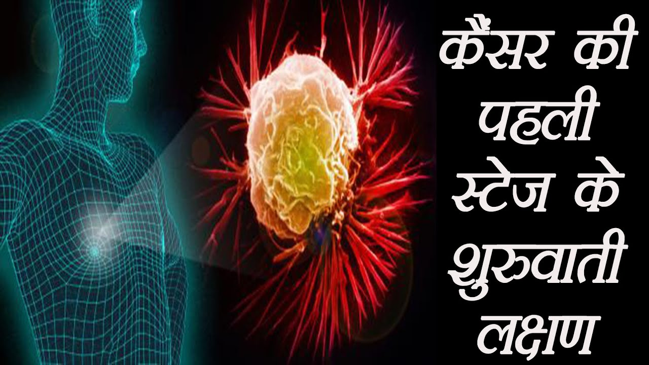 कैंसर के सामान्य 9 लक्षण अगर दिखे तो नज़रअंदाज़ ना करे cancer ke