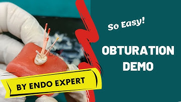 Obturation Made Easy! ENDODONTICS DEMO
