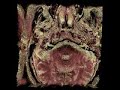 High Resolution MRI of Auditory Canal