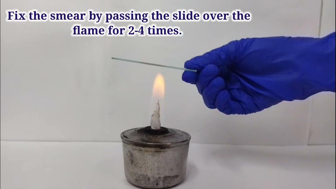 ZN Stain Procedure. Acid Fast Staining. YouTube