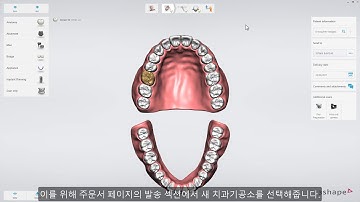 3Shape 트리오스 – 스캔 재전송 방법 – 3Shape TRIOS – How to re-send scan